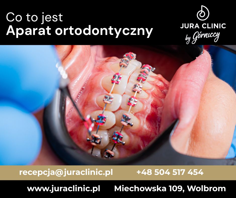 Aparat Ortodontyczny Jura Clinic By G rniccy Wolbrom aparat-ortodontyczny-jura-clinic-by-g-rniccy-wolbrom