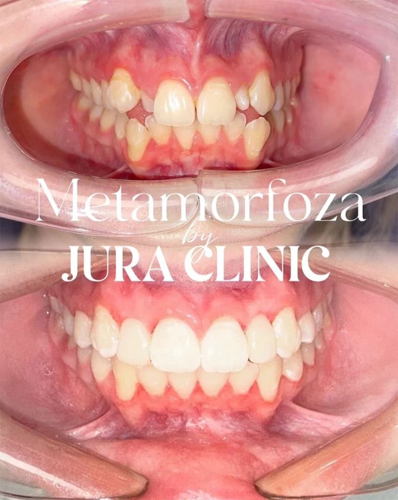 metamorfoza jura clinic ortodoncja2