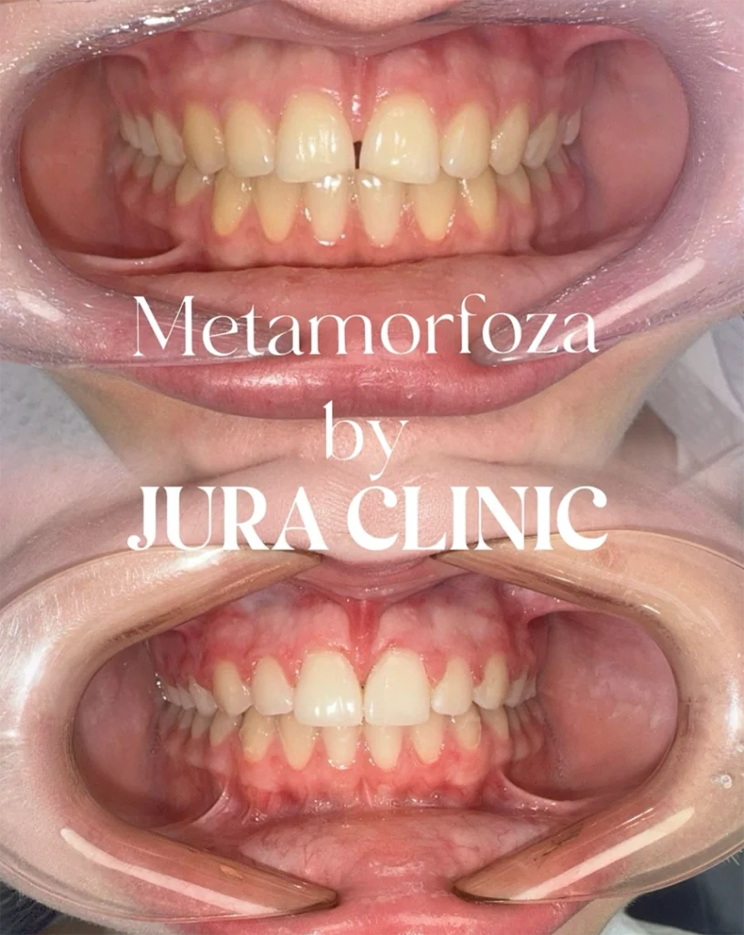 metamorfoza jura clinic ortodoncja3